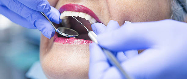 Best Emergency Dental Care for Abscessed Tooth in Clinton, IA